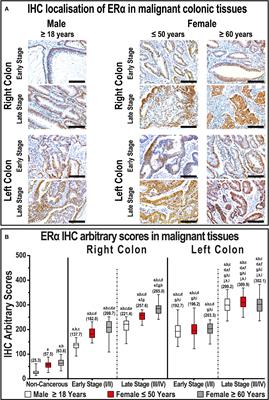 Profiling estrogen, progesterone, and androgen receptors in colorectal cancer in relation to gender, menopausal status, clinical stage, and tumour sidedness